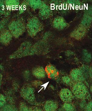 dupla marcação de células BrdU/ NeuN após injeção de BrdU em ratos com