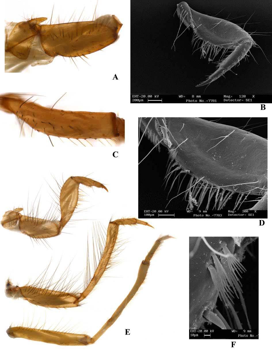 57 Figura 57: Larva Macronema sp. 3. Legenda: I. Trocantim e coxa da perna anterior - vista dorsolateral; J. Fêmur da perna anterior - vista ventral; K. Fêmur da perna anterior - vista dorsal; L.