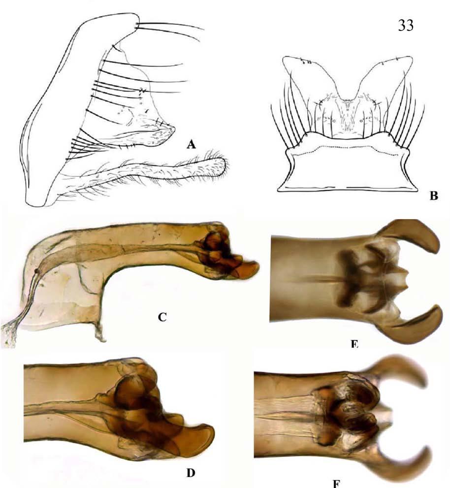 32 Figura 32: Macronema sp. nov. 1, asa anterior do macho, vista dorsal. Figura 33: Macronema sp. nov. 1. Genitália masculina: A vista lateral.