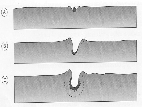 Como a idade dos meteoritos é semelhante à da Terra, surgiu a hipótese de que o material que os constitui representa o material sólido a partir do qual se A) formaram os cometas. B) formou a Terra.