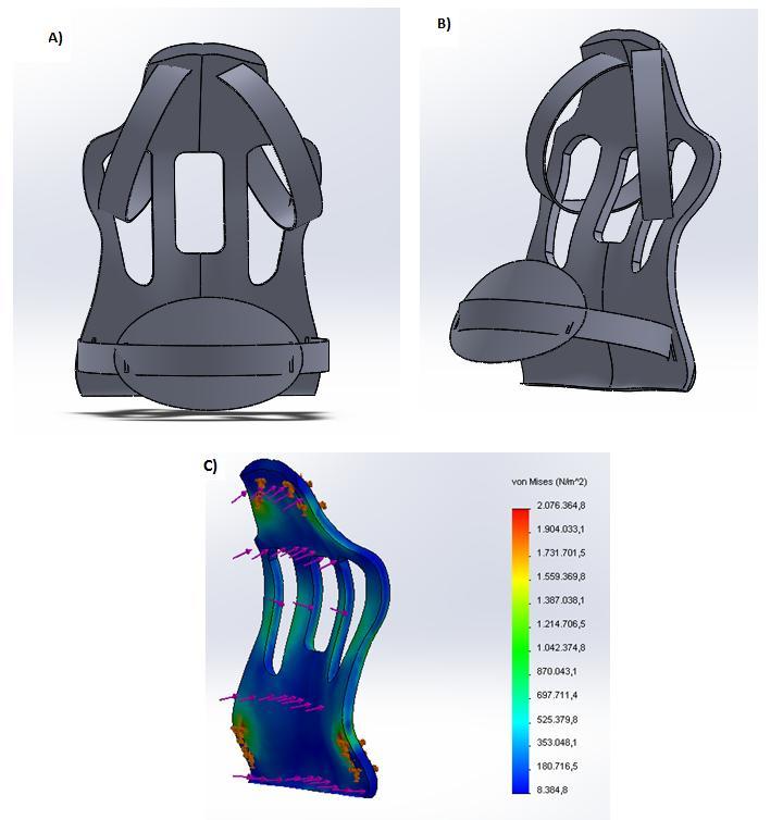 simulação realizada no software SolidWorks: distribuição das tensões gerais de