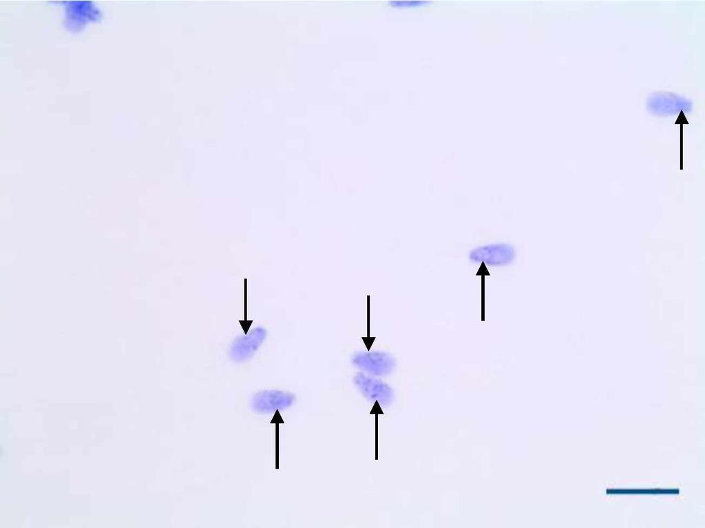 42 Figura 6 - Espermatozóides com artefato de técnica após seleção por Percoll. Artefatos identificados pelas setas. Barra: 10pm. 5.