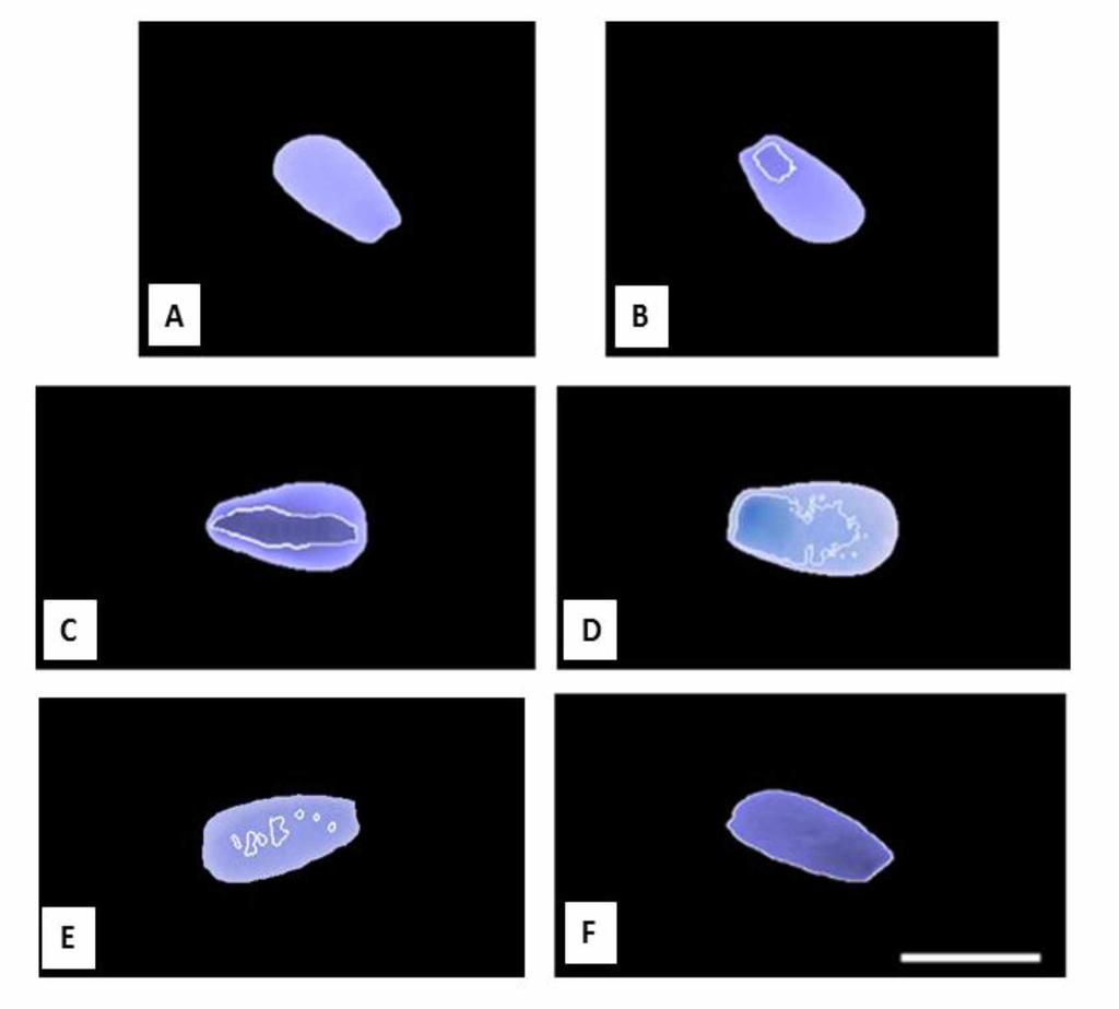 43 Figura 7 - Cabeças de espermatozóides bovinos com alterações cromatínicas identificados por análises de imagem computacional. Os esfregaços foram corados com AT.