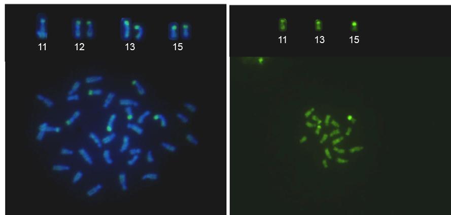 A B C D 5µm E Figura 16- Cromossomos metafásicos de