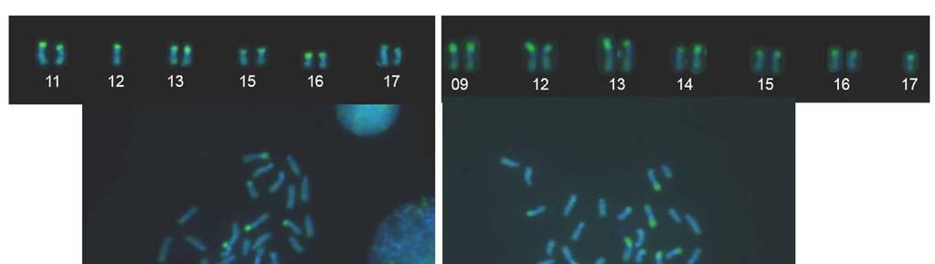 A B 5µm A C B Figura 17- Cromossomos metafásicos de Scaptotrigona