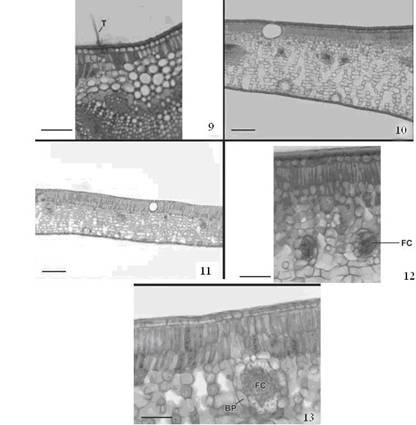 Anatomia Foliar de Eugenia involucratadc. e E. bracteata Vell. (Myrtaceae) Figura 9-13. Tricomas tectores em E.