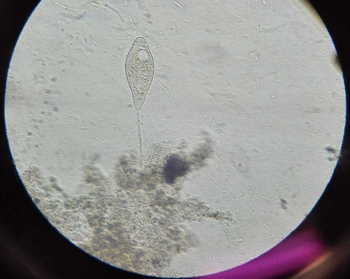 primeira sendo característica por se encontrar presente quando a CBO5 é reduzida [161] e a Vorticella Aquadulcis é indicadora de uma elevada eficiência de remoção de CBO5 [164].