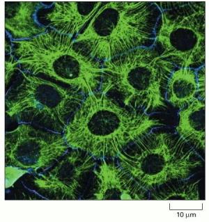 Filamentos de queraina em células epiteliais Micrografia de imunofluorescência de uma rede de filamentos de queraina (verde) em células epiteliais em