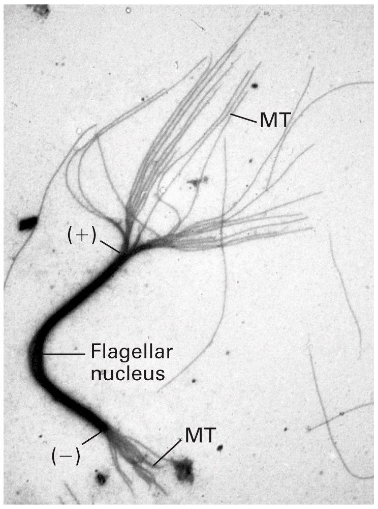 Micrografia eletrônica de fragmentos de um feixe de MT de um