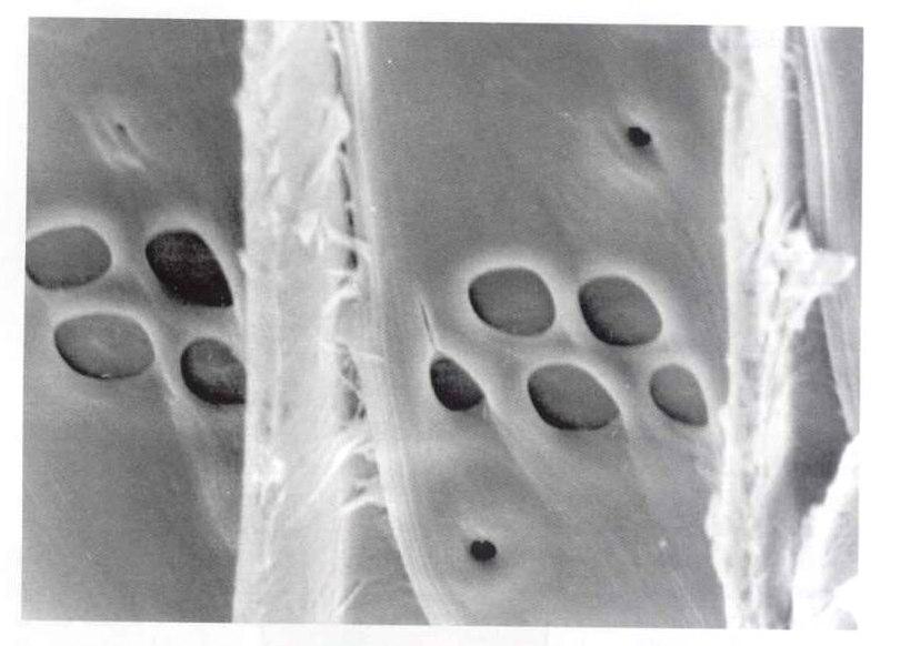 tipo II Pinoide tipo I