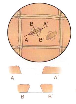 CONÍFERAS (Resinosas)