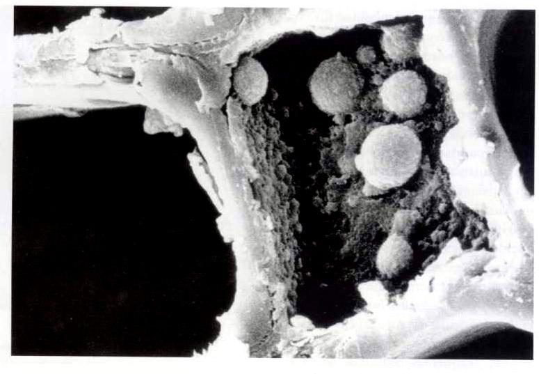 Parênquima longitudinal Células vivas que servem como elementos condutores e de armazenamento Apresenta-se em forma de colunas longitudinais.