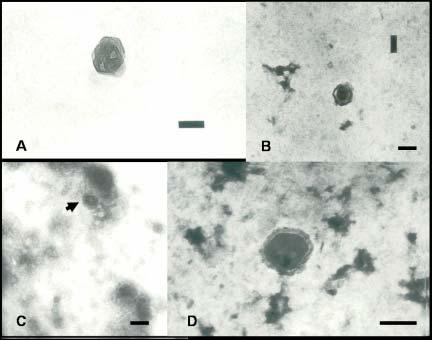 Figura 5. Microscopia eletrônica do CLRDV em plantas com Doença azul do algodoeiro. Partículas virais forma coradas com contraste negativo. A Aumento de 160.000 x, PTA, ph 6,2; B 120.