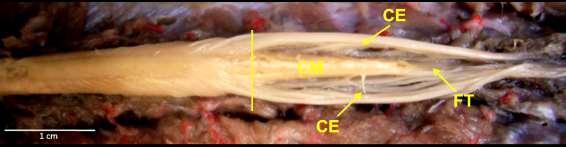 Notou-se também que os prolongamentos dos ramos nervosos, lombares e sacrais formavam a cauda equina e o término da medula foi determinado pela presença do filamento terminal (Figura 2).