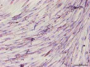 Efeito da criopreservação no tempo de diferenciação osteogênica e adipogênica das Células Tronco Mesenquimais provenientes da Membrana Amniótica.