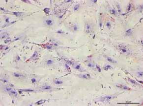 As células cultivadas em meio indutor de diferenciação adipogênica e corados com Oil Red e contracorada com Hematoxilia apresentaram gotículas lipídicas no