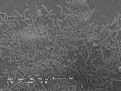 Comparando-se as duas micrografias, pode-se confirmar que a presença de fundentes (amostra RCM) provoca a formação de fase vítrea em maior quantidade, o que tem levado a dissolução da mulita.