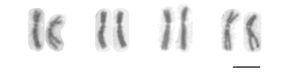 Figure 2 Second-largest pair of chromosomes indicating the presence of the secondary constriction at least