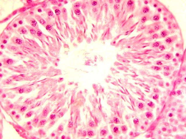 espermatogônias e células de Sertoli, correspondendo ao escore 3 (ampliada  C Fotomicrografia de túbulo