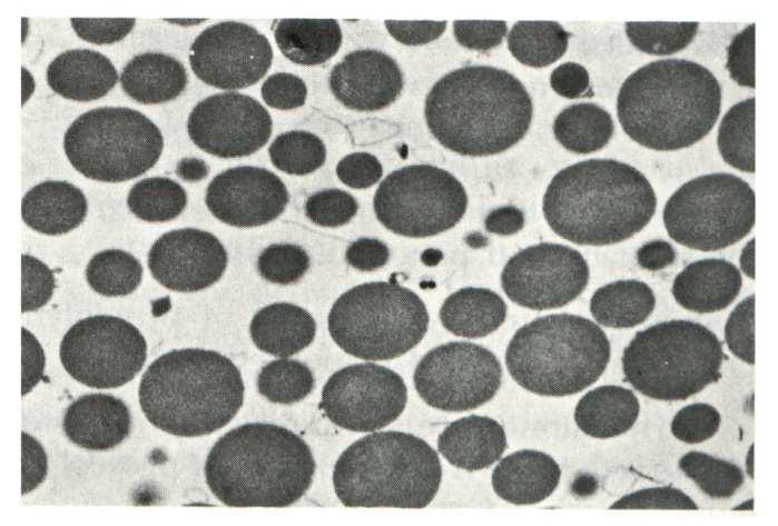 grânulos de zimogénio em células do pâncreas libertação dos