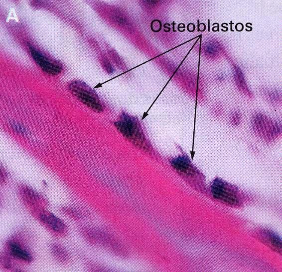 Osteoblastos: células jovens, com muitos prolongamentos e intensa