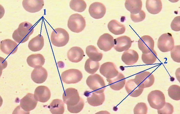 Fragmentos de células Plaquetas ou trombócitos: minúsculos discos redondos ou ovais (cerca de 2 m de diâmetro) que participam do processo de coagulação