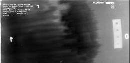 corrosão pois a utilização da peça no ensaio acrescenta espessura e altera a densidade da imagem radiográfica do filme naquela região, como mostra a imagem 5.