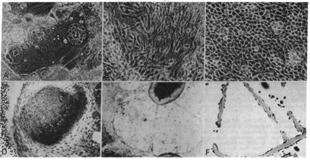 blastocisto inner cell mass Meio + nutrientes ESC Outer = trofoectoderma Evans and Kaufman, 1981 1986 Andrew Lassar and Harold Weintraub of Seattle, converted rodent fibroblasts directly into