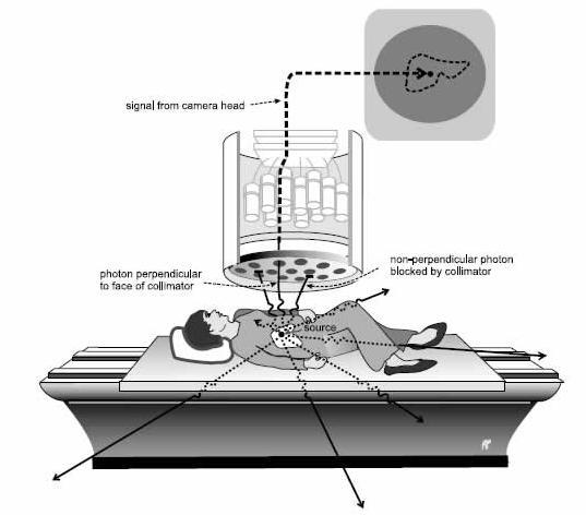 Página161 Os colimadores devem ser escolhidos de acordo com a aplicação e o radioisótopo. O sistema detector é composto por um cristal cintilador de iodeto de sódio dopado de tálio.