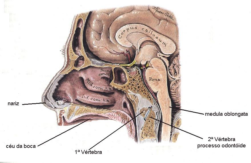 A Vértebra, implicará em esmagamento da medula por fratura da apófise odontóide exatamente na transição entre o bulbo e a medula chamada
