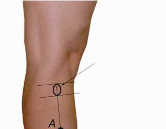 Tuberosidade tibial 4 dedos de