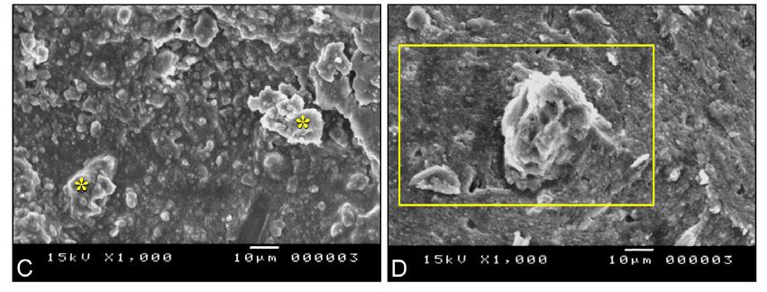 Fotomicrografias (MEV) de amostras obturadas com o cimento Apexit Plus após os diferentes tratamentos das paredes dos canais radiculares. A. Água Destilada: os asteriscos representam locais cobertos por cimento; B.