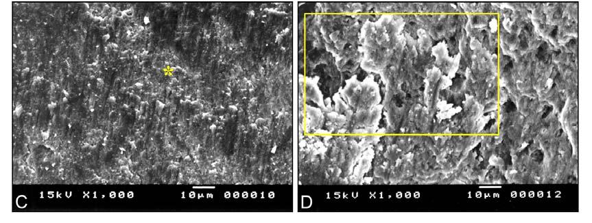 Fotomicrografias (MEV) de amostras obturadas com o cimento Epiphany Espatulado após os diferentes tratamentos das paredes dos canais radiculares. A.