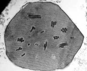 Grupo: Grupo I (dsdna) Família: Baculoviridae Gêneros