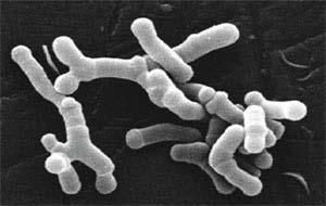 Exemplo 2 8 4 2 IV Fatorial Fracionário : Determinação dos parâmetros mais importantes para o cultivo de Bifidobacterium longum (Kiviharju, K.