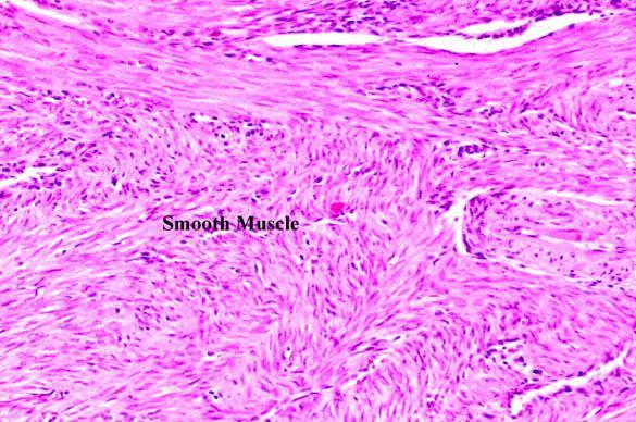 Útero - Miométrio Arteríola Musculso liso A