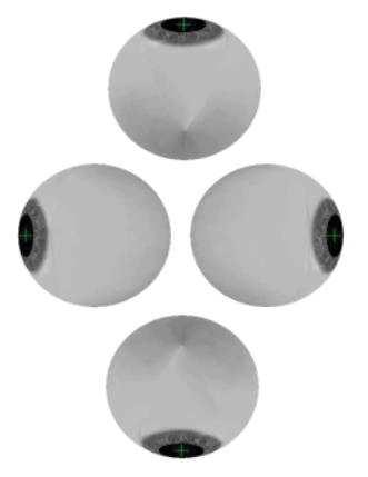 80 AMPLITUDE: Máxima amplitude do globo ocular, em graus. Um parâmetro configurável que foi definido como 60º, limite ilustrado na Figura 7.