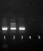 30 Figura 2: Resultado da M-PCR para a detecção do DNA do BoHV-5 em gel de agarose a 2% das amostras da Universidade Estadual de Londrina.