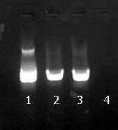 31 Figura 3: Resultado da M-PCR para a detecção do DNA do BoHV-5 em gel de agarose a 2% das amostras do matadouro.