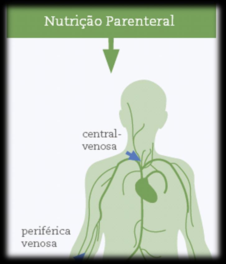 (ANVISA, RDC nº272, 1998) O que é NUTRIÇÃO PARENTERAL?