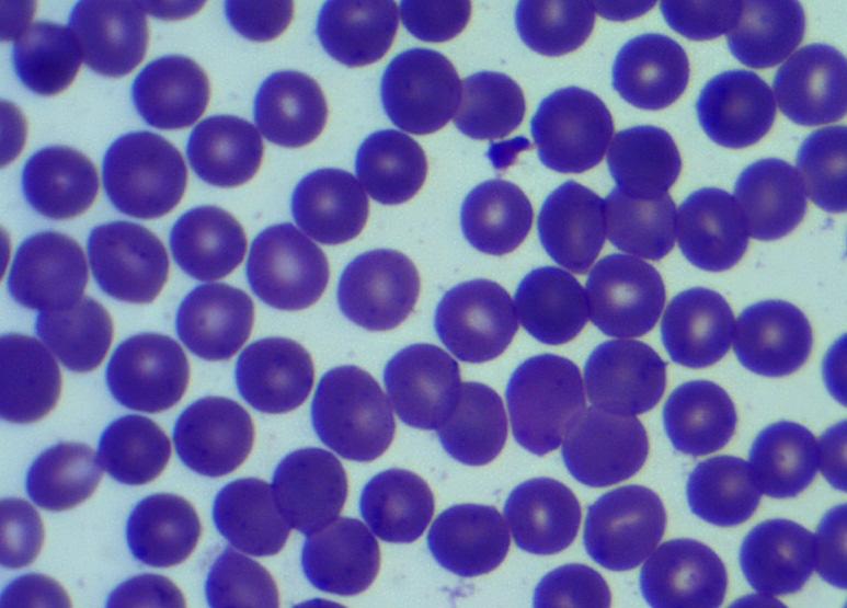 Imagem 1: Hemácias bem distribuídas no esfregaço sanguíneo com fácil visualização das plaquetas.
