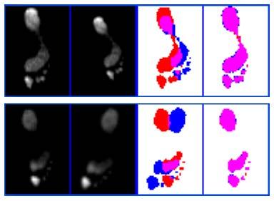 Alinhamento Alinhamento de imagens de pedobarografia: transformada de Fourier Imagens originais Imagens antes e após