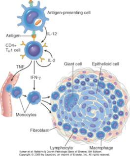 tecidual grave e fibrose 25 Inflamação