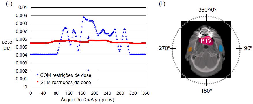 29 Figura 14: (a) UM em função do ângulo do gantry para plano de VMAT de cabeça e pescoço com e sem limites de tolerância de dose para a região com implante dentário.