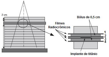 41 concordância entre duas distribuições de dose, através de tolerâncias de aceitação de dose (D) e de distância (d) avaliadas simultaneamente, conforme a equação: (2) Tal equação é calculada pelo