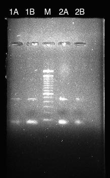 46 Figura 12 - Perfil eletroforético da amplificação do material genético de quatro amostras. Coluna 1A: material obtido de 20 raspagens no primeiro paciente.