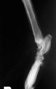 extensão dos ossos longos, e o diagnóstico do segundo caso foi firmado como Osteopatia Hipertrófica Pulmonar (Figuras 7, 8, 9 e 10).