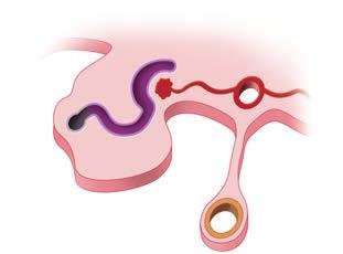 Observar o cordão craniocaudal de tecido (cordão nefrogênico), com segmentação na região cranial (pronefro).