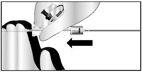 AVISO: Evite rodar a pega do eixo exterior ao puxar o eixo para trás, pois isso poderia causar uma instalação imprecisa. 20.