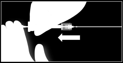 AVISO: O filtro poderá diminuir de tamanho ao ser instalado: Abordagem femoral: a ponta de filtro craniana poderá ficar até 1,5 cm a caudal do local de instalação inicial.